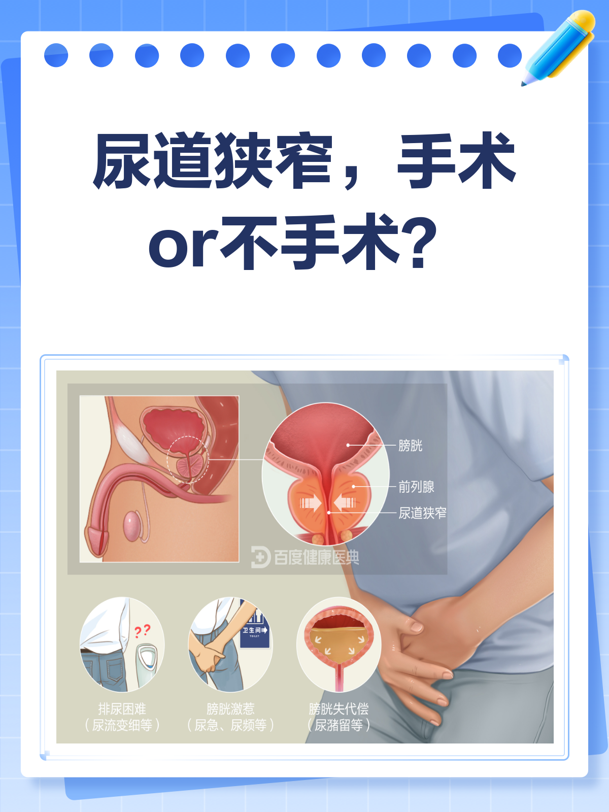 尿道狭窄必须手术吗?一文给你讲明白!