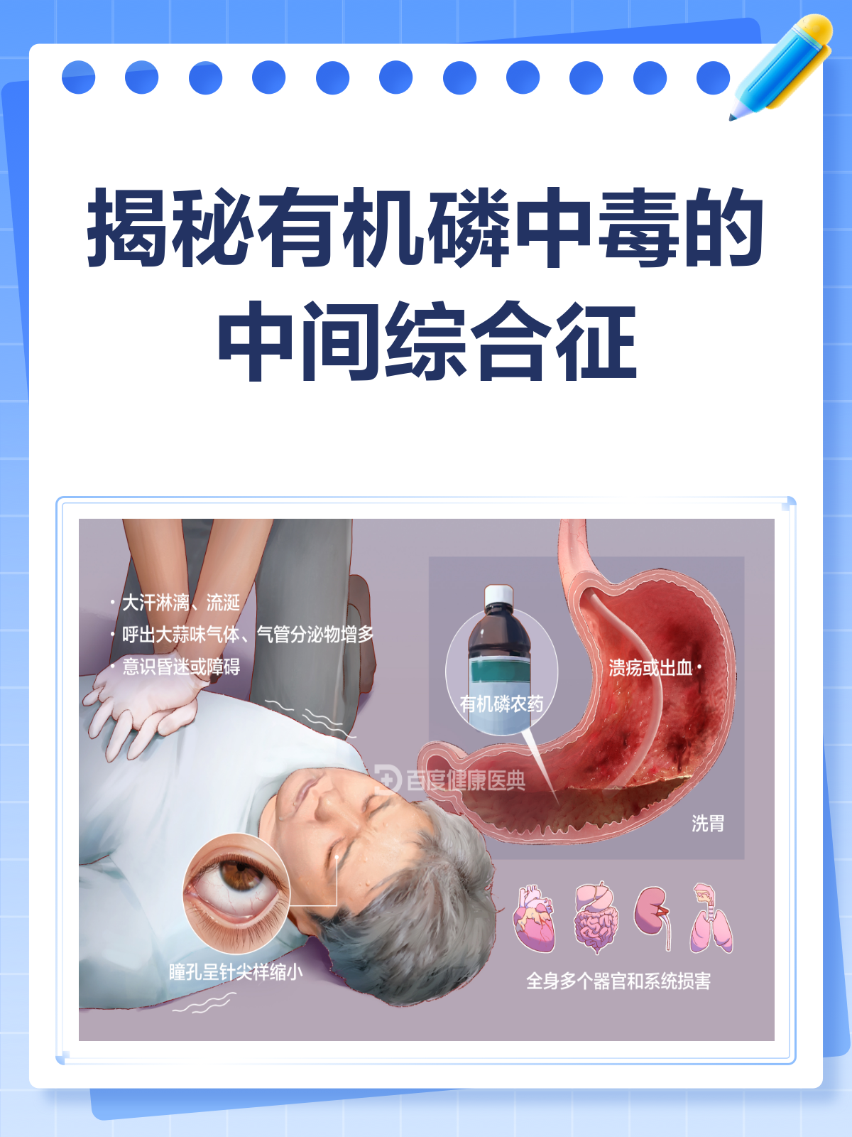 警惕!有机磷农药中毒后的隐秘杀手👀