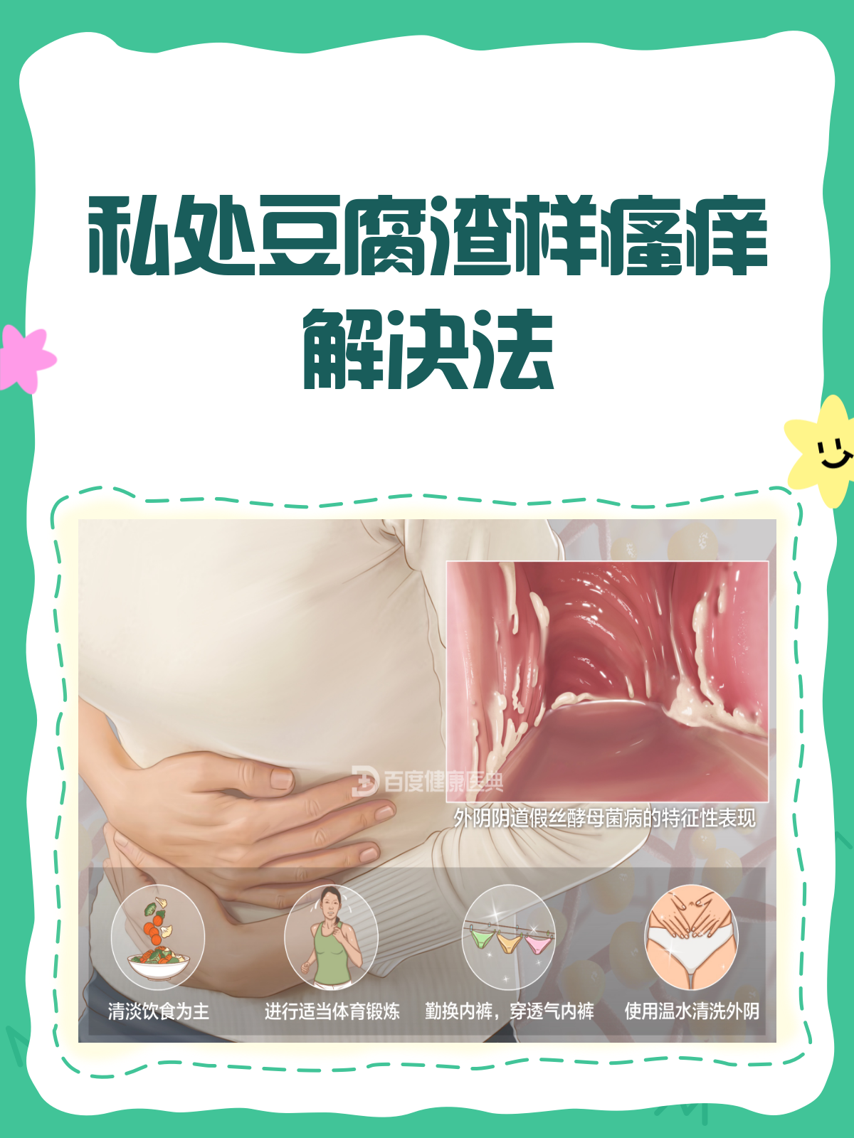 下面痒还有豆腐渣?别急,这样应对!💡