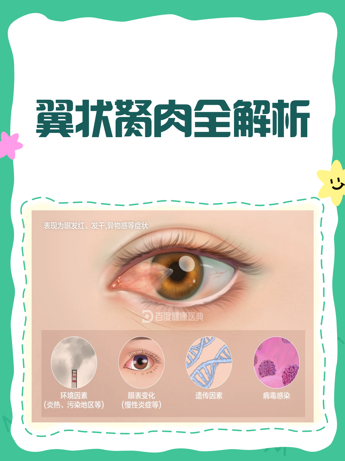 翼状胬肉来袭?了解它,才能战胜它!👀