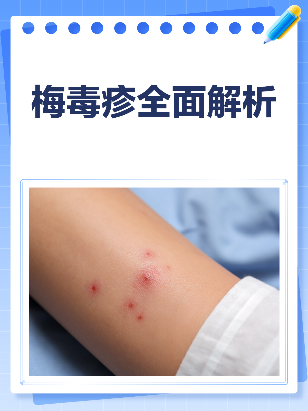 梅毒疹来袭?了解症状,早防早治!