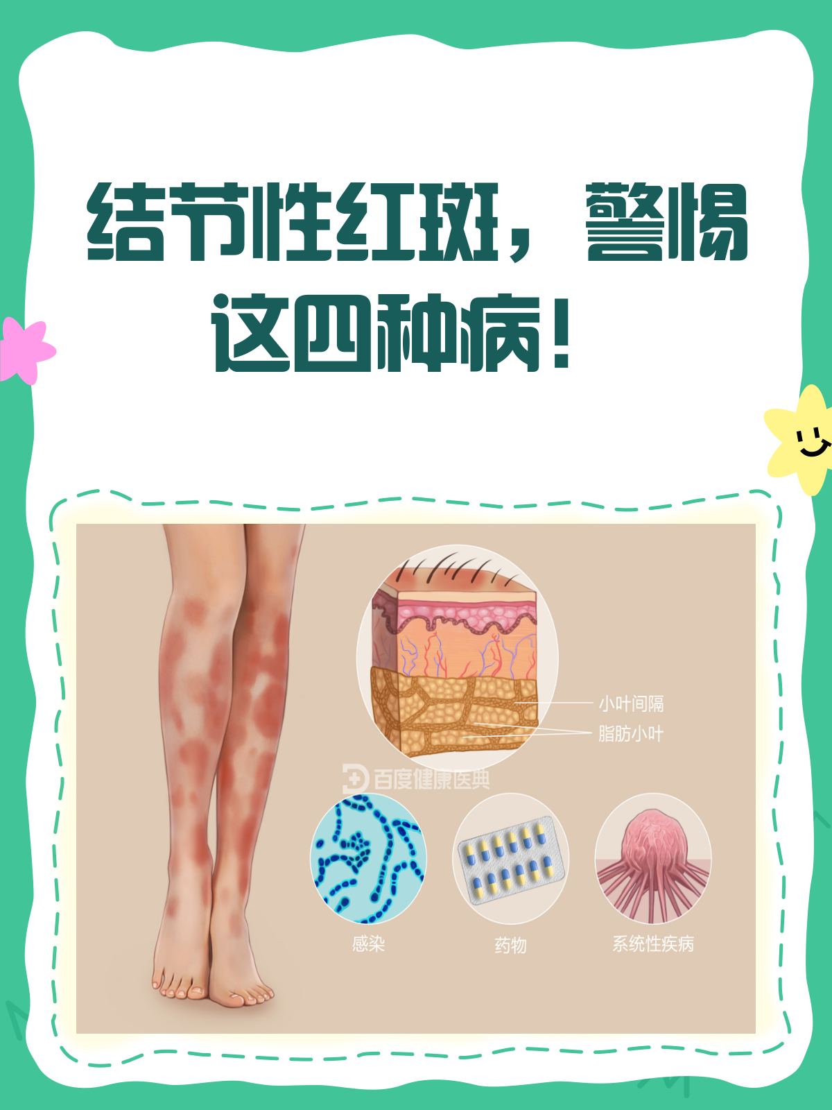 结节性红斑🚨,可能是这4种病的信号!