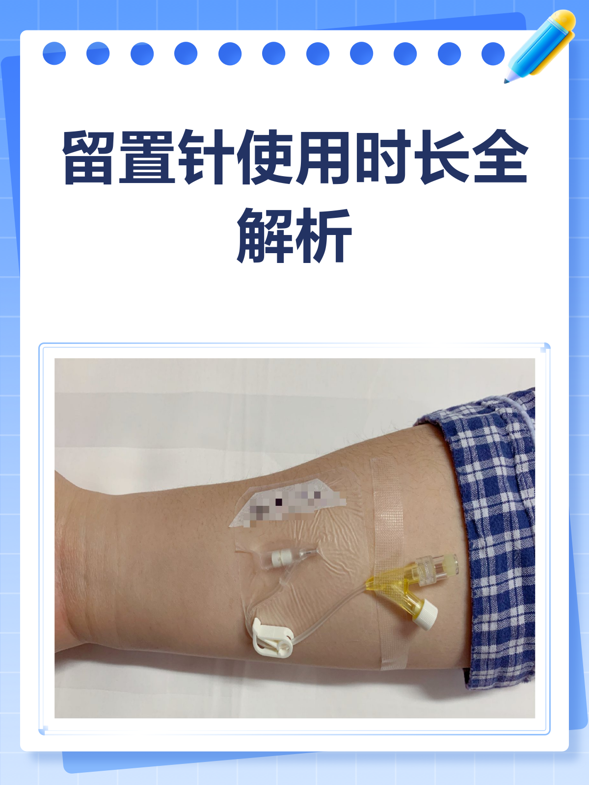 留置针能用几天?看完这篇就懂了!