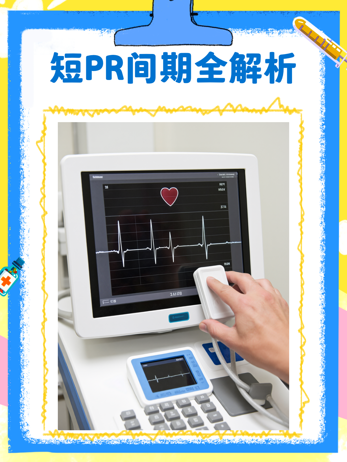 心电图上的短pr间期,你了解多少?💡