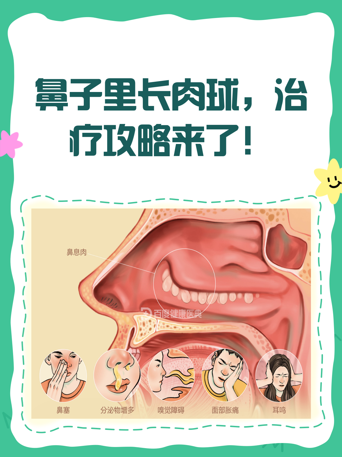 鼻子里的肉球?别急,一文教你如何应对!