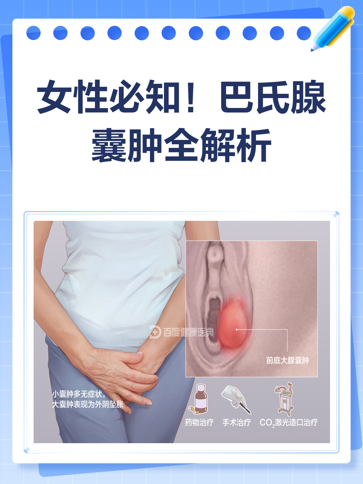 🔍什么是巴氏腺囊肿?