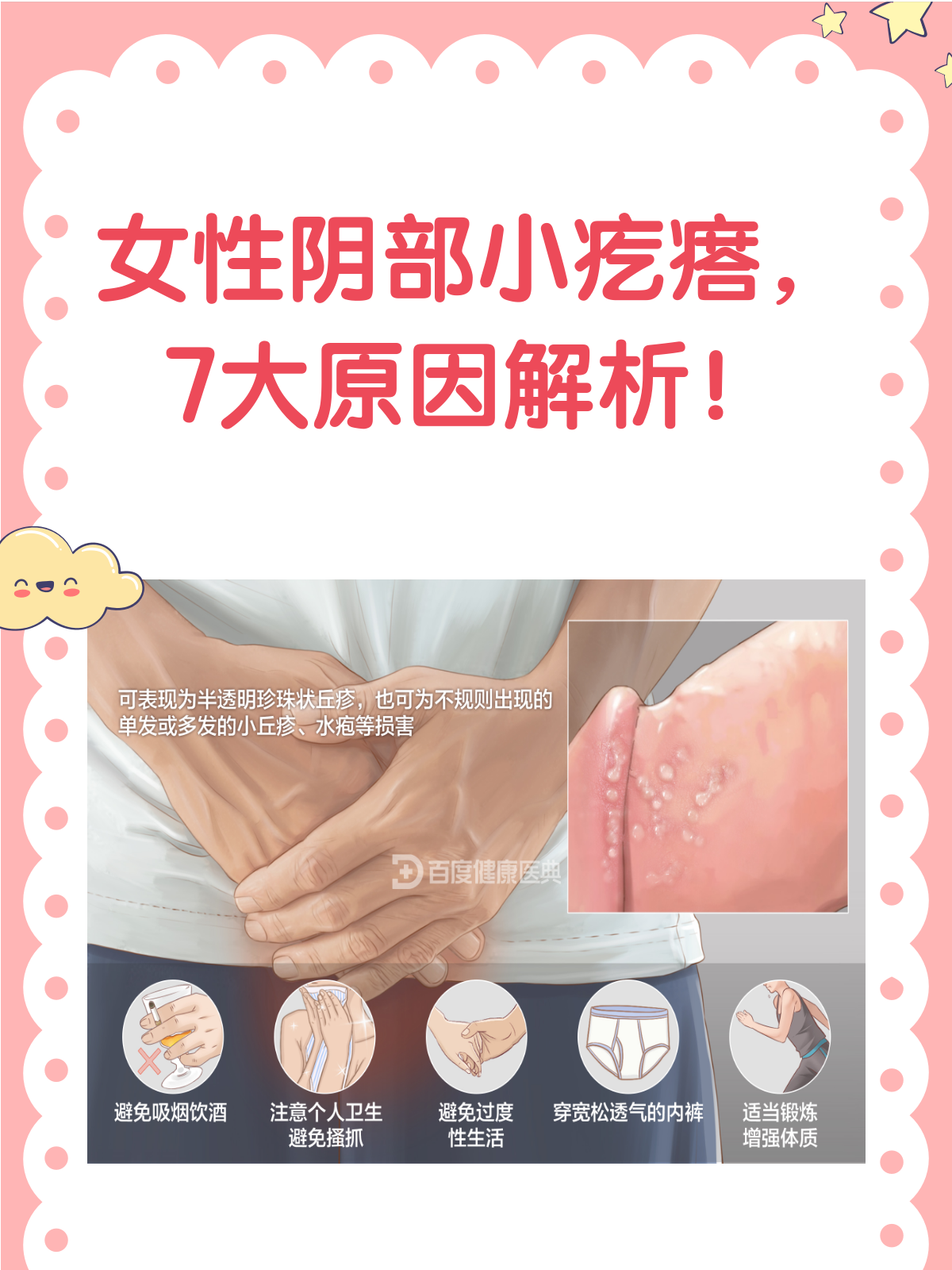 🚺女生阴部小疙瘩,这些原因你知道吗?