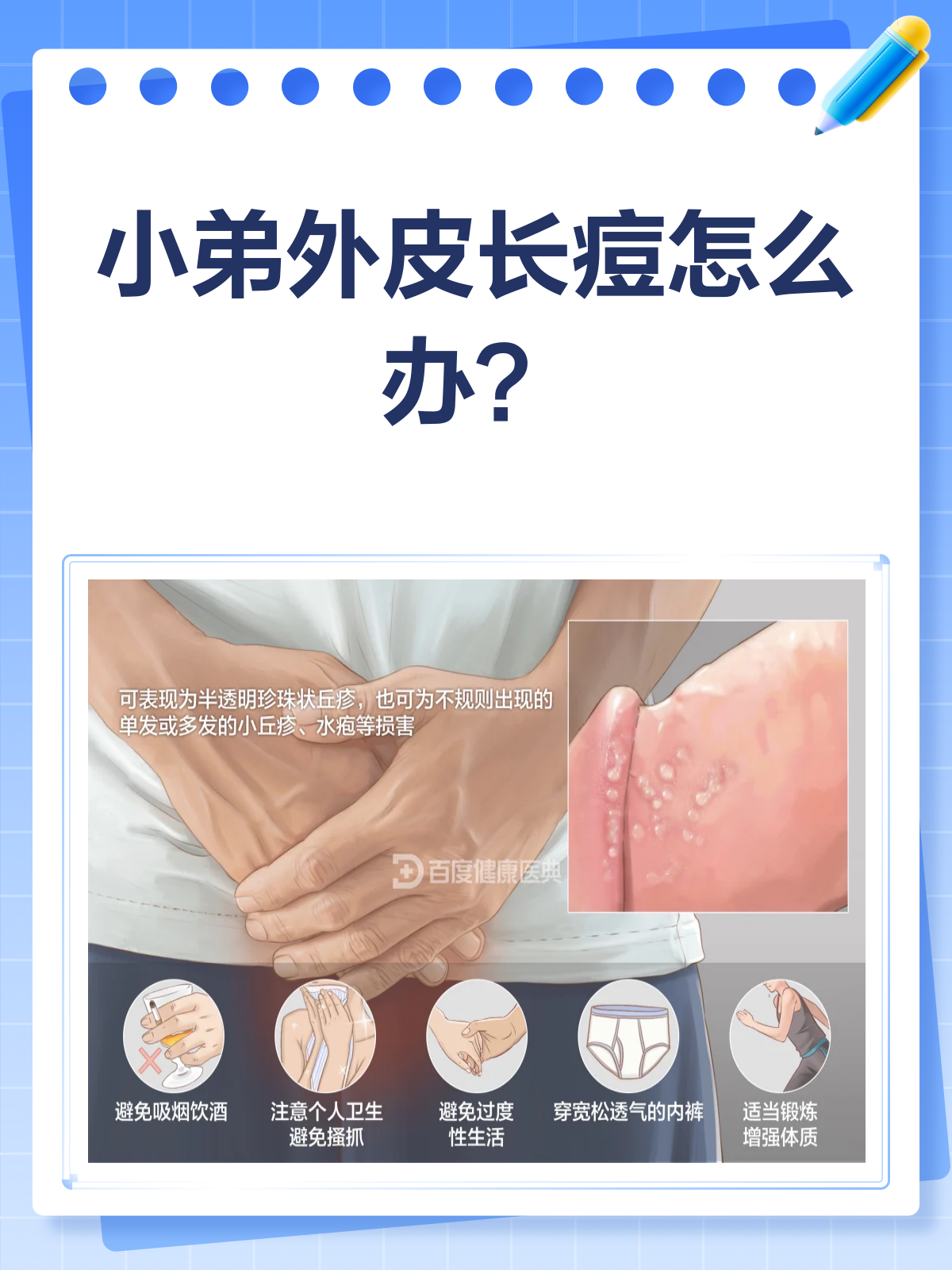医学科普我来添彩#哎呀,发现小弟外皮上长了痘痘,是不是心里有点? ?