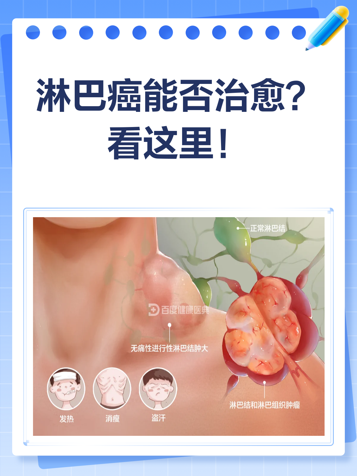 淋巴癌能否治愈?一文带你了解真相!