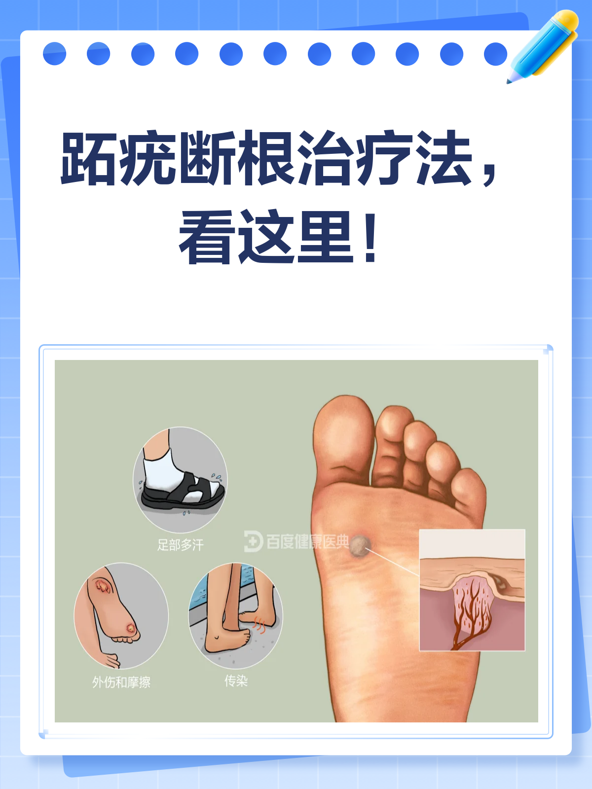 为什么会长瘊子原因是什么为什么在线 为什么会长瘊子原因是什么为什么在线