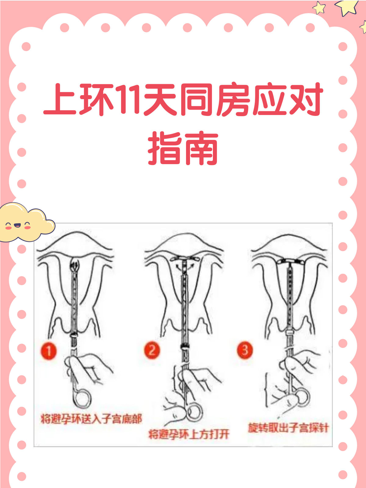 上环11天同房了,接下来该怎么办?