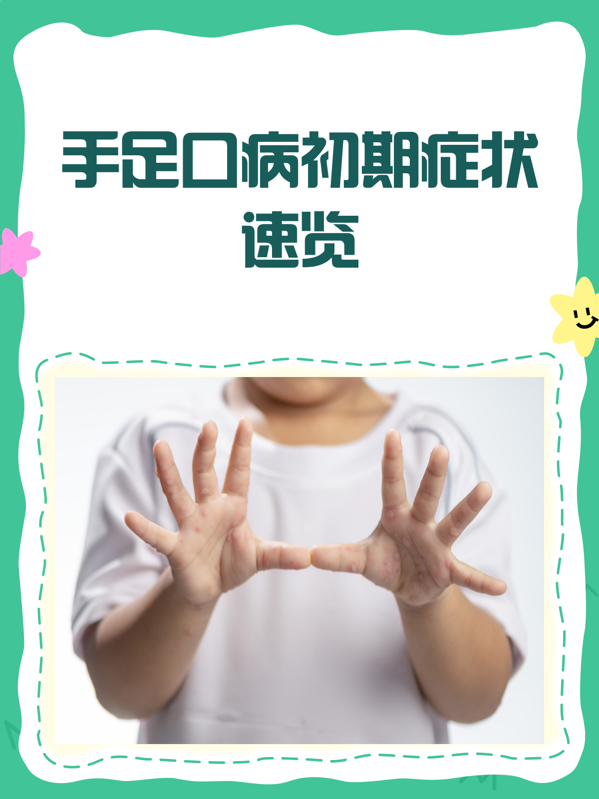 警惕!手足口病初期症状全解析🔍