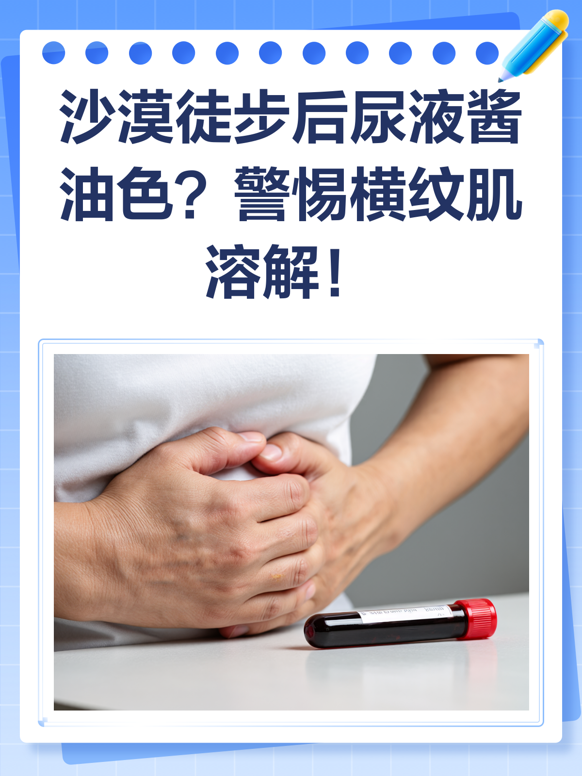 沙漠徒步后尿液酱油色?小心横纹肌溶解!